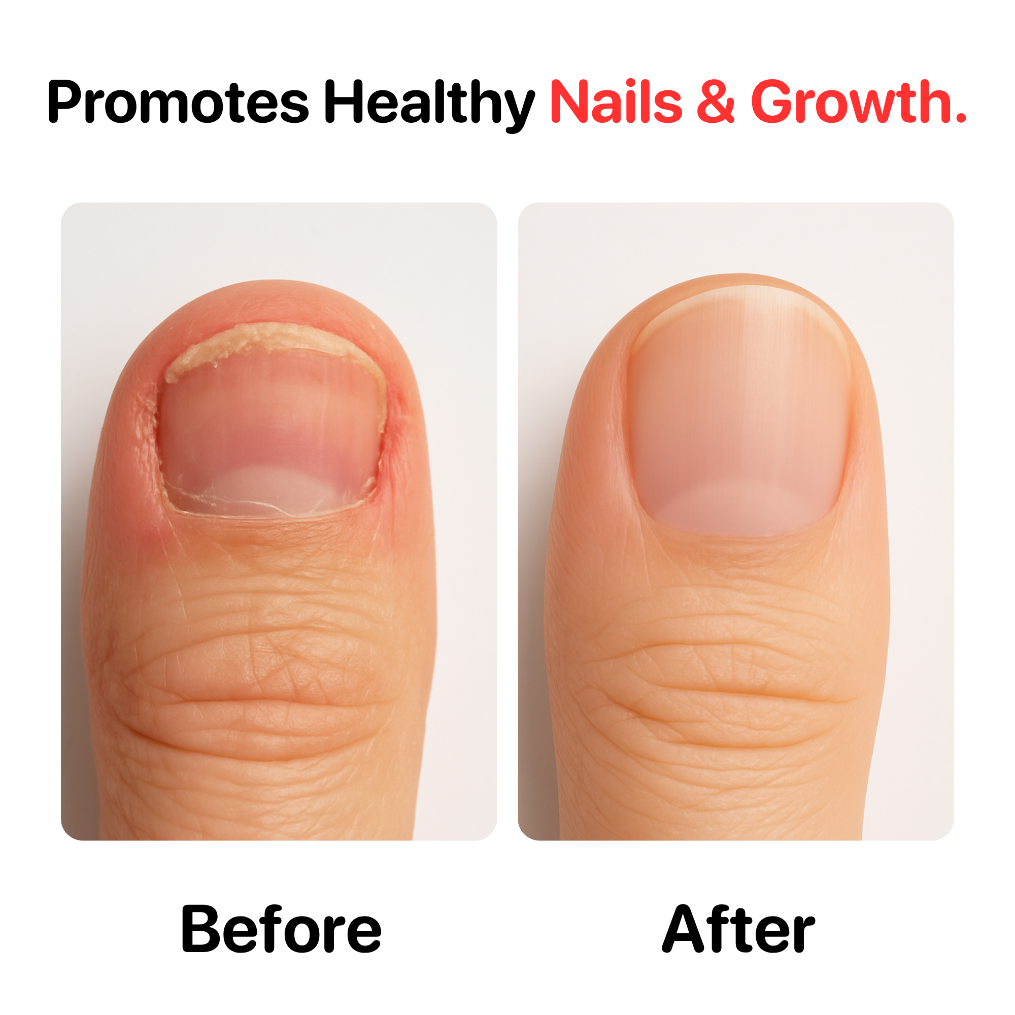 Nail Biting Prevention 0.5 fl oz